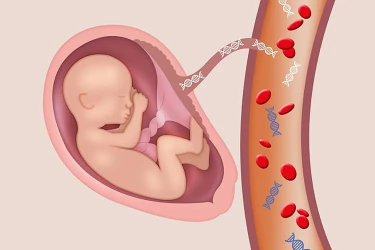 ADN fetal en células libres para detectar síndrome de Down