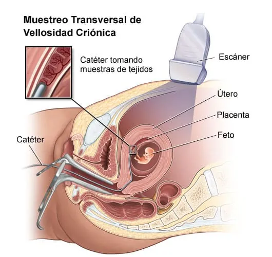 Muestra de vellosidades coriónicas 