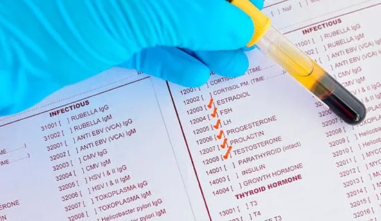 Prolactina alta e infertilidad: hiperprolactinemia
