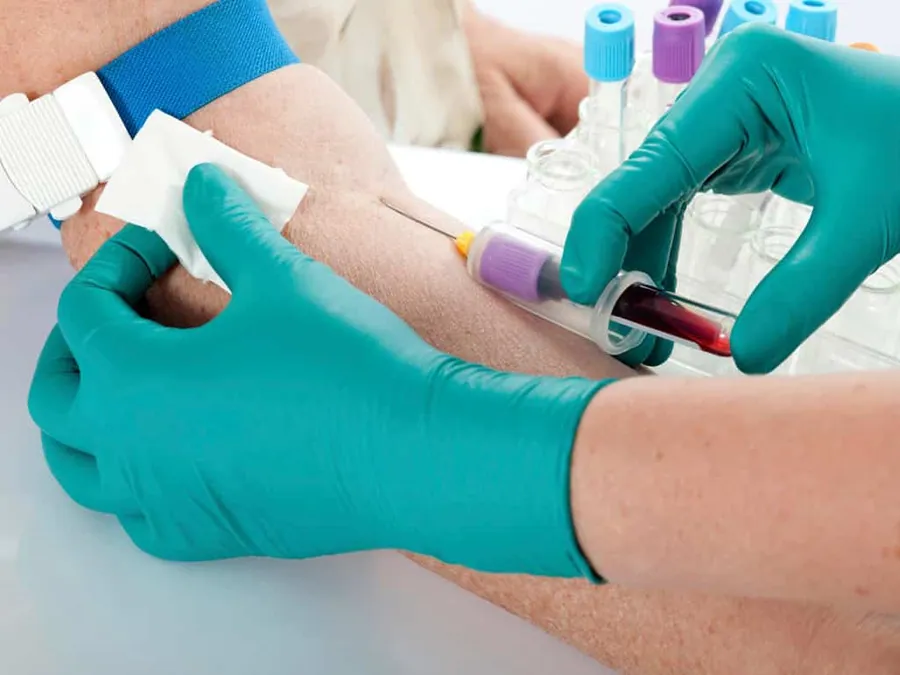 Prueba alfafetoproteína (AFP) en el embarazo